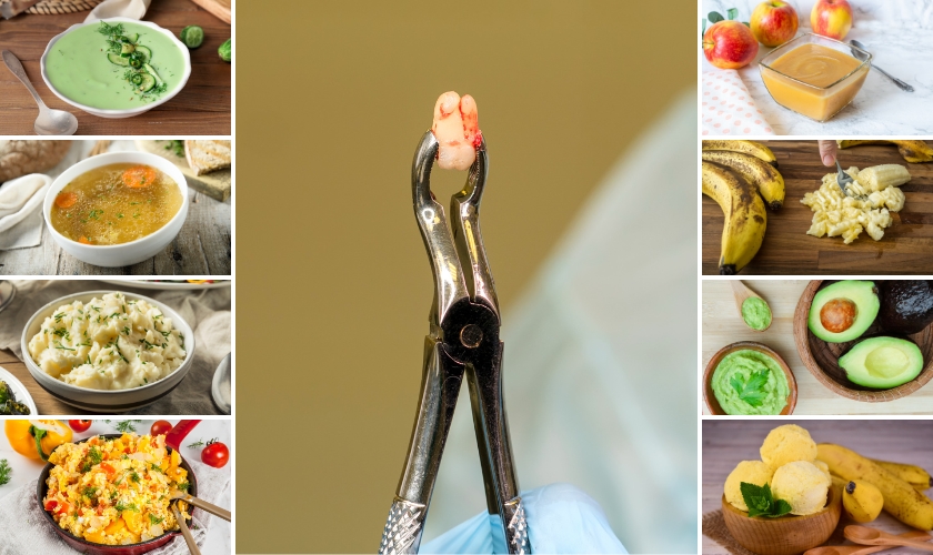 what can you eat after wisdom teeth removal