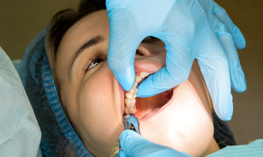 should i have all my wisdom teeth removed at once